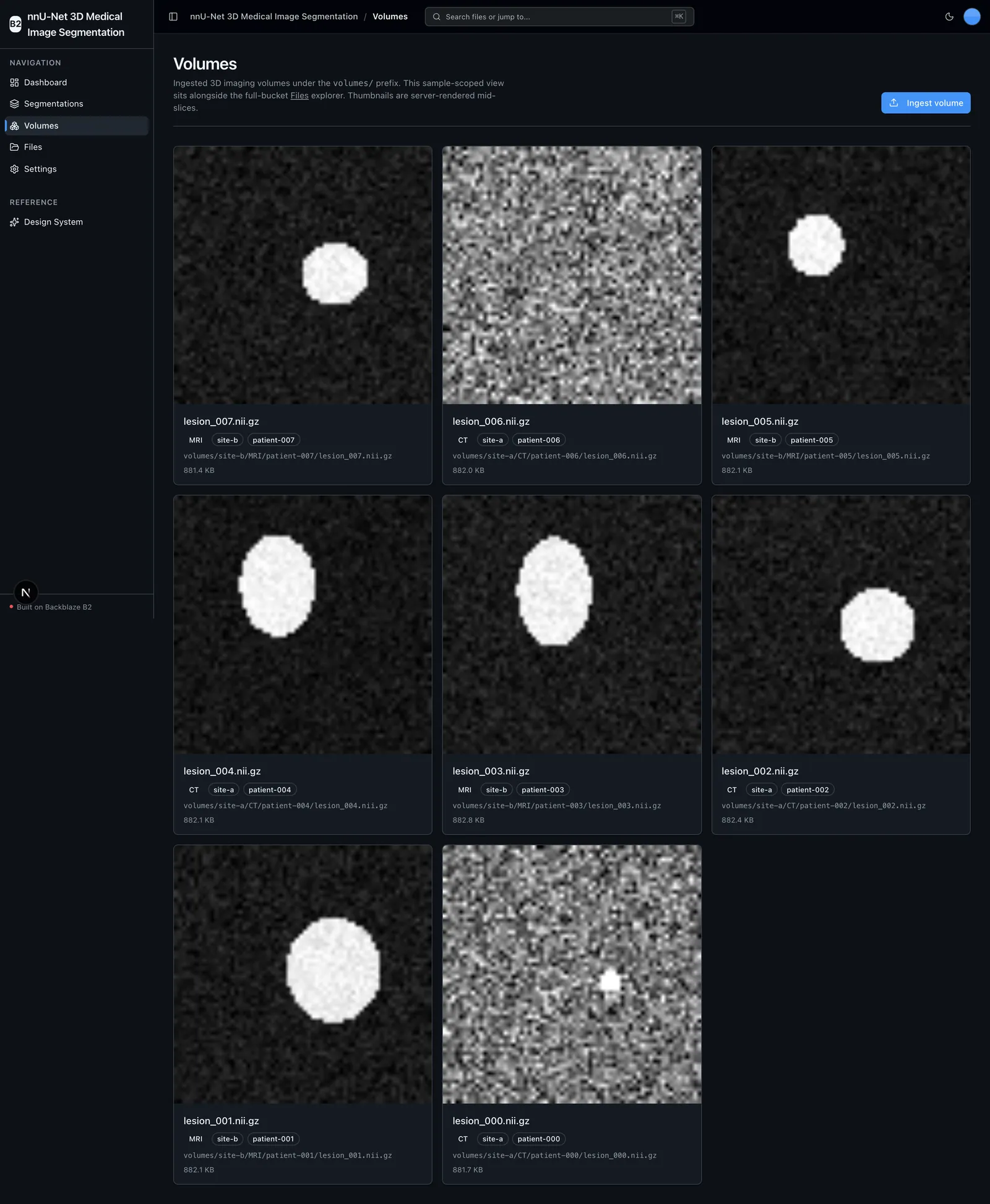 Volumes grid of ingested CT and MRI volumes with mid-slice thumbnails