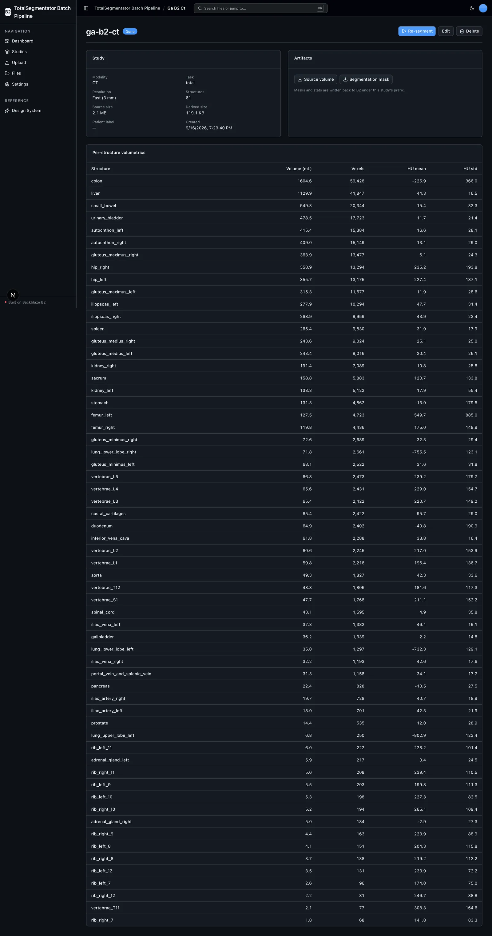 Study detail view with artifacts and a per-structure volumetrics table of volume, voxels and Hounsfield stats